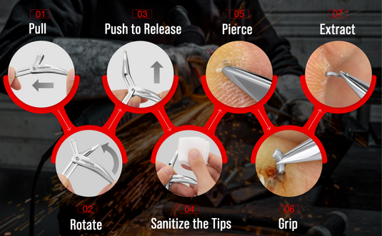 Effortless Splinter Removal in Simple Steps