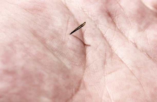 Safe and Effective Splinter Removal Using DUROX Splinter  Removal Tweezers