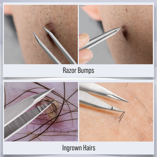 Pointed Precision Tweezer Set - 3 Pieces