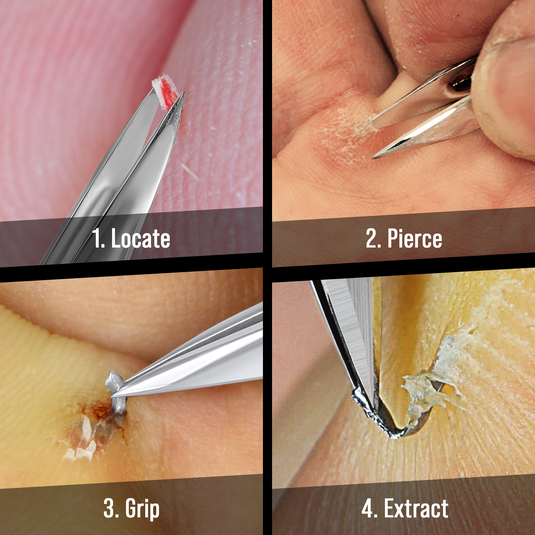 Splinter Tweezers