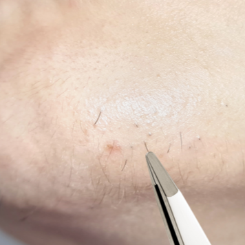 Safety Tweezers with Small Round Tips
