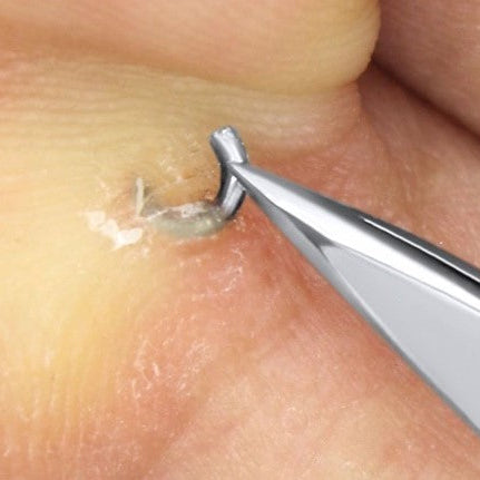 Splinter Tweezers